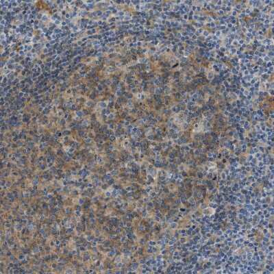 Immunohistochemistry-Paraffin: RIPK2 Antibody [NBP1-86630]