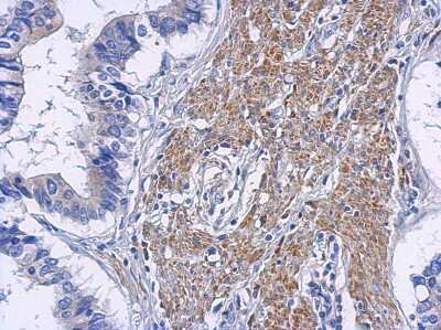 Immunohistochemistry-Paraffin: RIPK2 Antibody [NBP2-20167]