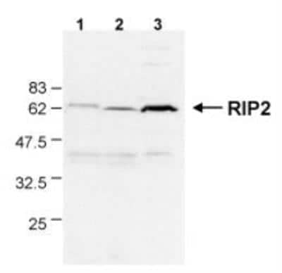 Western Blot: RIPK2 Antibody (Nick-1)BSA Free [NBP1-97631]