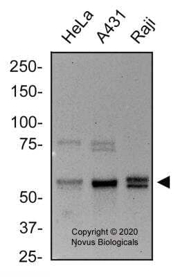 Western Blot: RIPK2 AntibodyBSA Free [NBP1-32424]