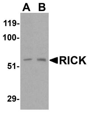 Western Blot: RIPK2 AntibodyBSA Free [NBP1-76873]