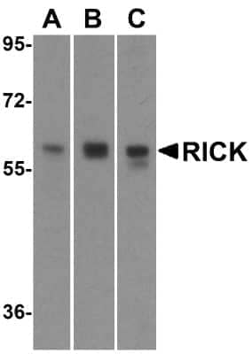 Western Blot: RIPK2 AntibodyBSA Free [NBP1-76960]