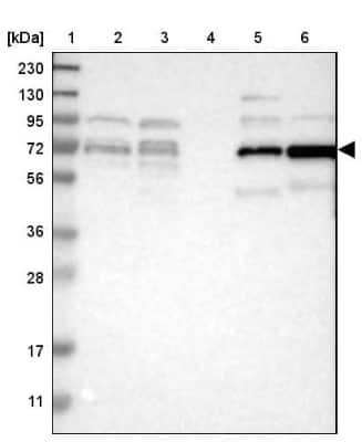 Western Blot: RIPK2 Antibody [NBP1-86629]