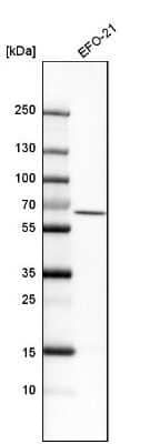 Western Blot: RIPK2 Antibody [NBP1-86630]