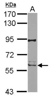 Western Blot: RIPK2 Antibody [NBP2-20167]