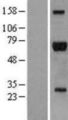 Western Blot: RIPK2 Overexpression Lysate [NBL1-15378]