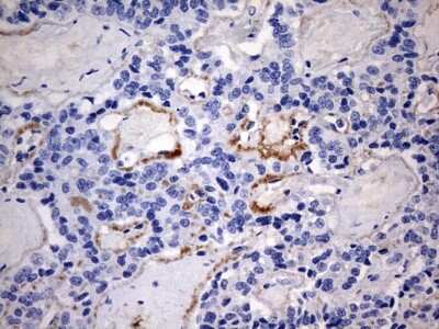 Immunohistochemistry: RIPK3/RIP3 Antibody (OTI1B3) [NBP2-45592]