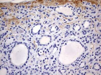 Immunohistochemistry: RIPK3/RIP3 Antibody (OTI1B3) [NBP2-45592]