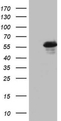 Western Blot: RIPK3/RIP3 Antibody (OTI1B3) [NBP2-45592]