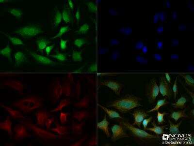 Immunocytochemistry/ Immunofluorescence: RIPK3/RIP3 Antibody - BSA Free [NBP2-24588]