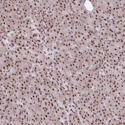 Immunohistochemistry-Paraffin: RIPK3/RIP3 Antibody [NBP2-49167]