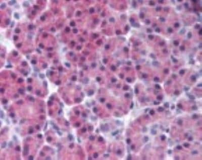 Immunohistochemistry-Paraffin: RIPK3/RIP3 Antibody - BSA Free [NBP2-24588]