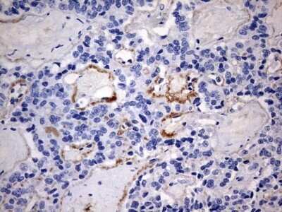 Immunohistochemistry: RIPK3/RIP3 Antibody (OTI1B3) - Azide and BSA Free [NBP2-73912]