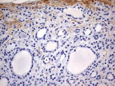 Immunohistochemistry: RIPK3/RIP3 Antibody (OTI1B3) - Azide and BSA Free [NBP2-73912]