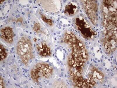 Immunohistochemistry: RIPK3/RIP3 Antibody (OTI1B3) - Azide and BSA Free [NBP2-73912]