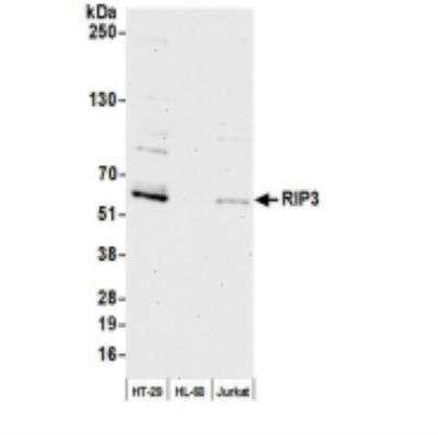 Western Blot: RIPK3/RIP3 Antibody [NBP2-32257]