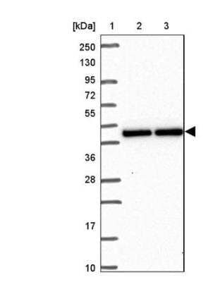 Western Blot: RIPK3/RIP3 Antibody [NBP2-49167]