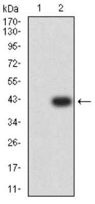 Western Blot: RIPK4 Antibody (1F7D9)BSA Free [NBP2-61860]