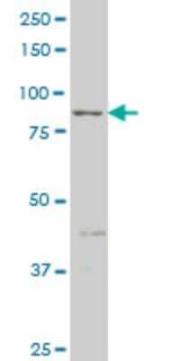 Western Blot: RIPK4 Antibody (1G2) [H00054101-M02]