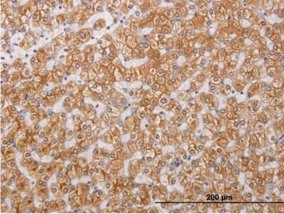 Immunohistochemistry-Paraffin: RIPK4 Antibody (2D1) [H00054101-M05]
