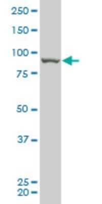 Western Blot: RIPK4 Antibody (2D1) [H00054101-M05]