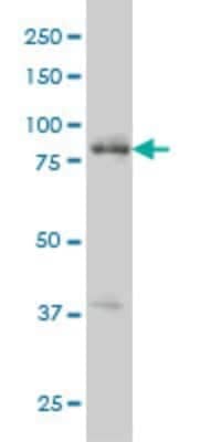 Western Blot: RIPK4 Antibody (2G3) [H00054101-M01]