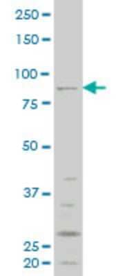 Western Blot: RIPK4 Antibody (3B1) [H00054101-M03]