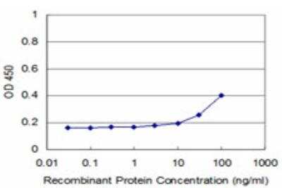 ELISA: RIPK4 Antibody (4H5) [H00054101-M04]