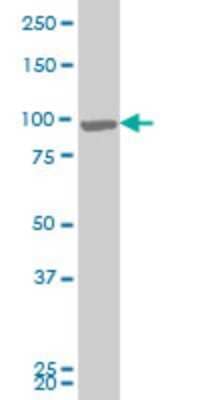 Western Blot: RIPK4 Antibody (4H5) [H00054101-M04]