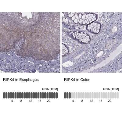 Immunohistochemistry-Paraffin: RIPK4 Antibody [NBP2-62605]