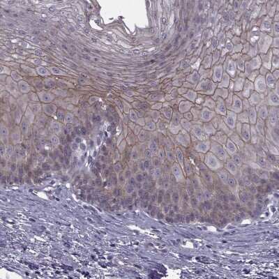 Immunohistochemistry-Paraffin: RIPK4 Antibody [NBP2-62605]