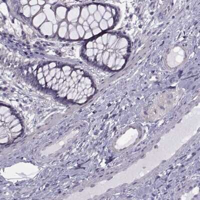 Immunohistochemistry-Paraffin: RIPK4 Antibody [NBP2-62605]