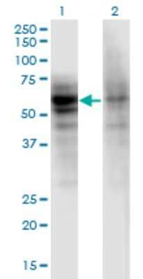 Western Blot: RIPK5 Antibody (1F9) [H00025778-M06]