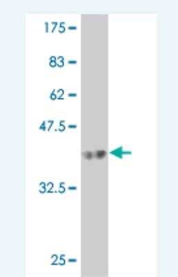 Western Blot: RIPK5 Antibody (4B3) [H00025778-M07]