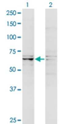 Western Blot: RIPK5 Antibody (4D5) [H00025778-M08]