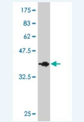 Western Blot: RIPK5 Antibody (4F3) [H00025778-M03]