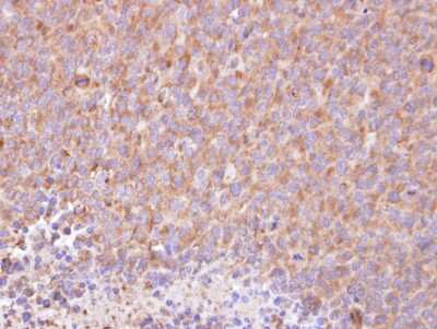 Immunohistochemistry-Paraffin: RIPK5 Antibody [NBP1-32646]