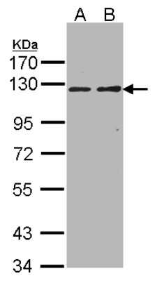 Western Blot: RIPK5 Antibody [NBP1-32646]