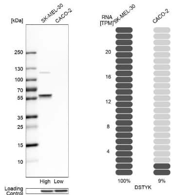 Western Blot: RIPK5 Antibody [NBP1-92336]