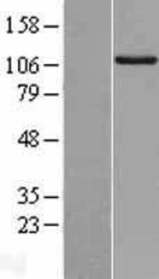 Western Blot: RIPK5 Overexpression Lysate [NBL1-15380]