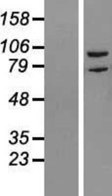 Western Blot: RIPK5 Overexpression Lysate [NBL1-15381]