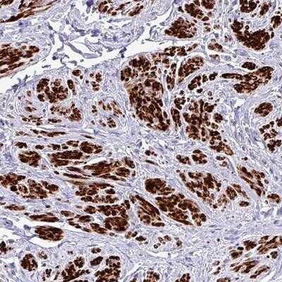 Immunohistochemistry-Paraffin: RIPPLY1 Antibody [NBP2-14766]