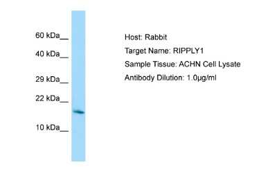 Western Blot: RIPPLY1 Antibody [NBP2-83450]