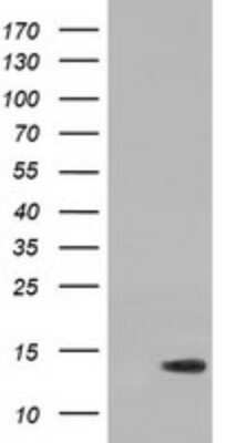 Western Blot: RIPPLY2 Antibody (OTI1B5) [NBP2-45961]