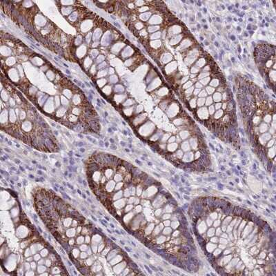 Immunohistochemistry-Paraffin: RIPPLY2 Antibody [NBP2-33489]