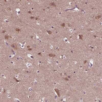 Immunohistochemistry-Paraffin: RIPX Antibody [NBP1-89614]