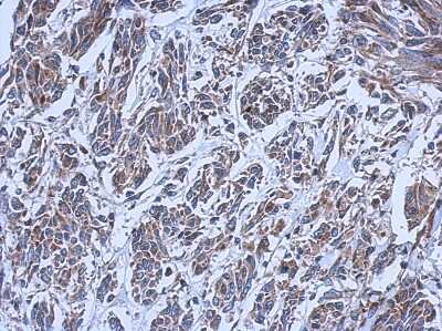 Immunohistochemistry-Paraffin: RIPX Antibody [NBP2-20168]