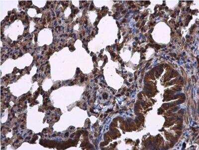 Immunohistochemistry-Paraffin: RIPX Antibody [NBP2-20168]