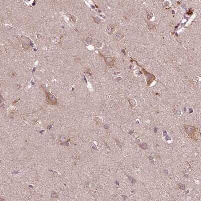 Immunohistochemistry-Paraffin: RIPX Antibody [NBP2-48558]