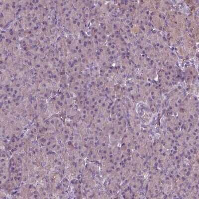 Immunohistochemistry-Paraffin: RIPX Antibody [NBP2-48558]